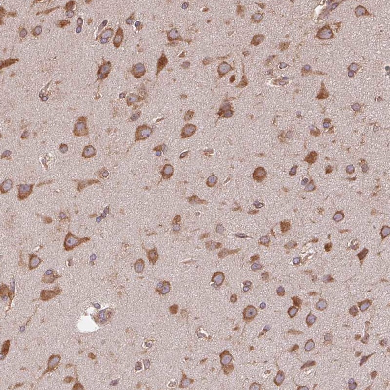 Anti-EIF2S1 Antibody