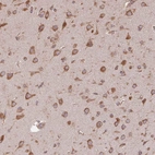 Anti-EIF2S1 Antibody
