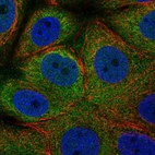 Immunofluorescent staining of human cell line MCF7 shows localization to cytosol.