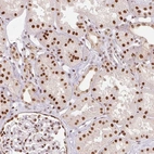 Anti-RTP4 Antibody