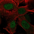 Immunofluorescent staining of human cell line SK-MEL-30 shows localization to nucleus.