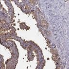 Immunohistochemical staining of human seminal vesicle shows high expression.
