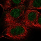 Anti-SGPP1 Antibody