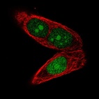 Immunofluorescent staining of human cell line PC-3 shows localization to nucleus & nucleoli.