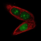 Immunofluorescent staining of human cell line PC-3 shows localization to nucleus & nucleoli.