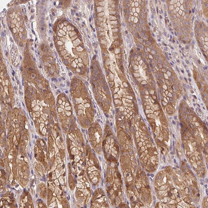 Anti-PRKAA1 Antibody