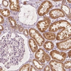 Immunohistochemical staining of human kidney shows high expression.