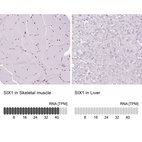 Anti-SIX1 Antibody