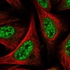 Immunofluorescent staining of human cell line U-2 OS shows localization to nuclear speckles.
