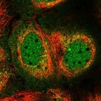 Immunofluorescent staining of human cell line A-431 shows localization to nucleoplasm, cytosol & the Golgi apparatus.