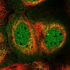 Immunofluorescent staining of human cell line A-431 shows localization to nucleoplasm, cytosol & the Golgi apparatus.