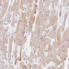 Immunohistochemical staining of human heart muscle shows moderate cytoplasmic positivity in cardiomyocytes.