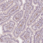 Immunohistochemical staining of human small intestine shows moderate cytoplasmic positivity in lymphoid cells.