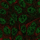 Immunofluorescent staining of human cell line RT4 shows localization to nucleoplasm.