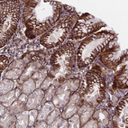Immunohistochemical staining of human Stomach shows moderate cytoplasmic and membranous positivity in glandular cells.