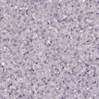 Immunohistochemical staining of human Liver shows very weak cytoplasmic positivity in hepatocytes.