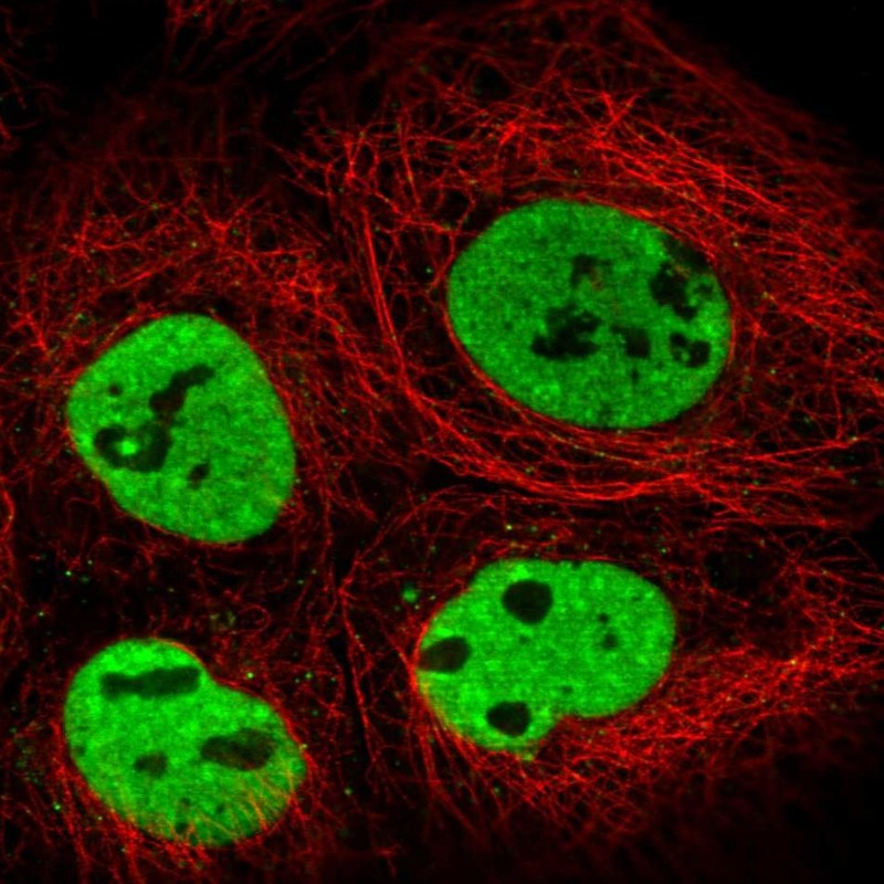 Anti-TRA2B Antibody
