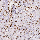 Anti-SIX1 Antibody