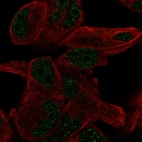 Anti-PGBD5 Antibody
