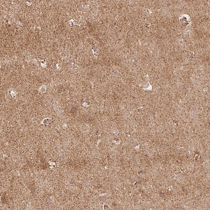 Anti-RIC3 Antibody