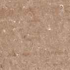 Anti-RIC3 Antibody