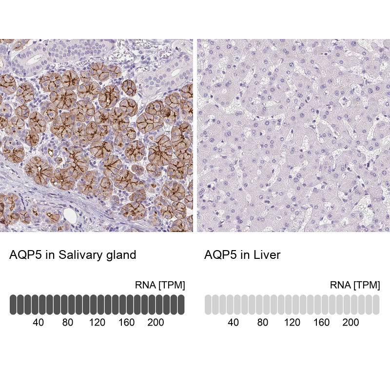 Anti-AQP5 Antibody