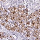 Immunohistochemical staining of human salivary gland shows strong positivity in apical membrane in glandular cells.
