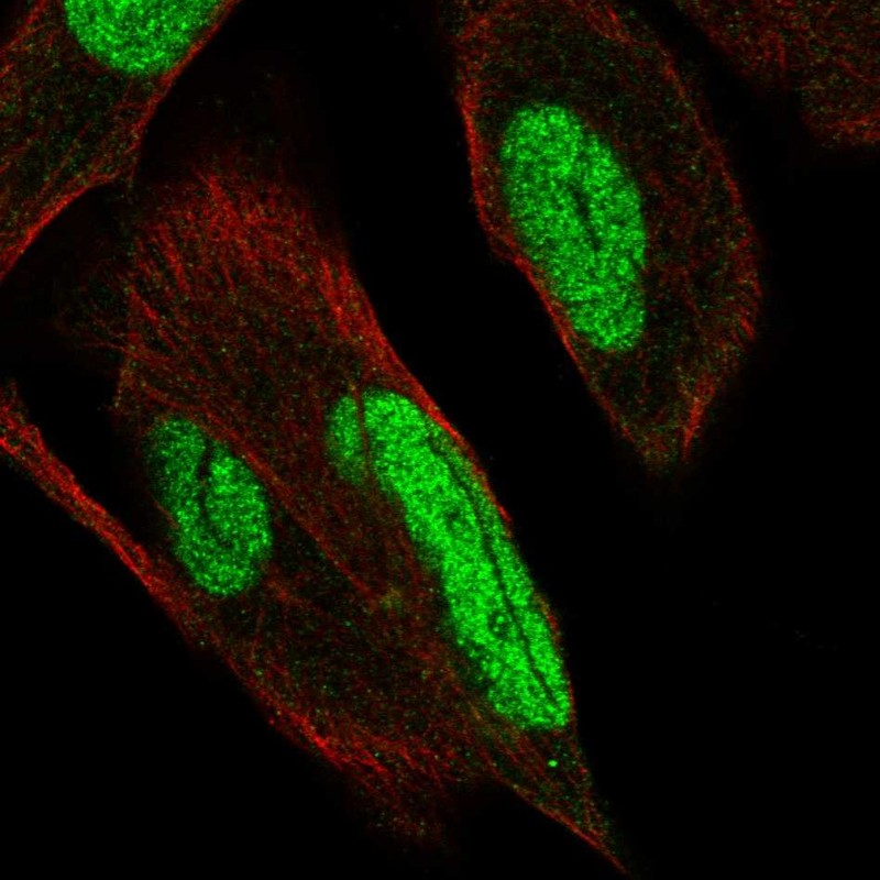 Anti-PKNOX1 Antibody