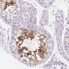 Immunohistochemical staining of human testis shows strong membranous positivity in subset of cells in seminiferous ducts.