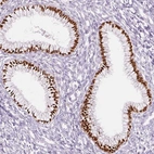 Immunohistochemical staining of human endocervix shows strong nuclear positivity in glandular cells.