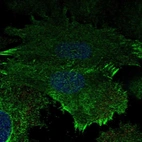 Immunofluorescent staining of human cell line SiHa shows localization to plasma membrane.