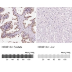 Anti-HOXB13 Antibody
