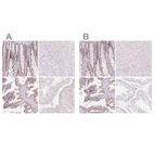 Immunohistochemical staining of human colon, liver, prostate and testis using Anti-HOXB13 antibody HPA065019 (A) shows similar protein distribution across tissues to independent antibody HPA062852 (B).
