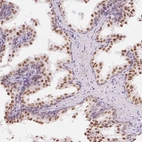 Immunohistochemical staining of human prostate shows strong nuclear positivity in glandular cells.