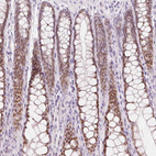 Immunohistochemical staining of human colon shows moderate nuclear positivity in glandular cells.
