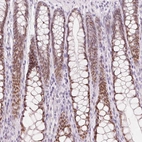 Immunohistochemical staining of human colon shows moderate nuclear positivity in glandular cells.