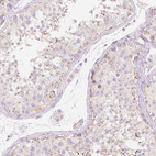 Immunohistochemical staining of human testis shows no nuclear positivity in cells in seminiferous ducts as expected.