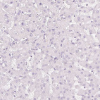 Immunohistochemical staining of human liver shows no nuclear positivity in hepatocytes as expected.
