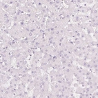 Immunohistochemical staining of human liver shows no nuclear positivity in hepatocytes as expected.