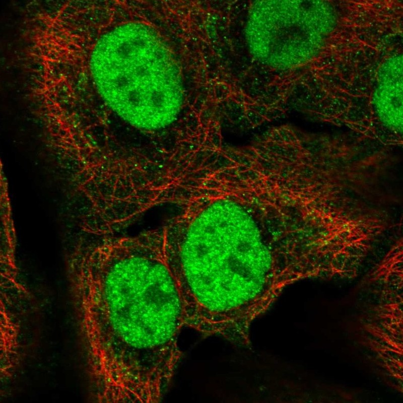 Anti-C18orf25 Antibody