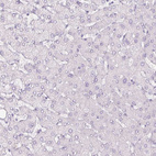 Immunohistochemical staining of human liver shows no positivity in hepatocytes as expected.