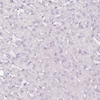 Immunohistochemical staining of human liver shows no positivity in hepatocytes as expected.
