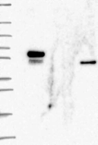 Lane 1: Marker [kDa] 250, 130, 95, 72, 55, 36, 28, 17, 10 | Lane 2: RT4 | Lane 3: U-251 MG | Lane 4: Human Plasma | Lane 5: Liver | Lane 6: Tonsil