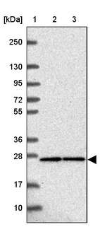 Lane 1: Marker [kDa] 250, 130, 95, 72, 55, 36, 28, 17, 10_br/_Lane 2: Human cell line RT-4_br/_Lane 3: Human cell line U-251 MG