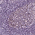 Anti-IL17C Antibody