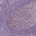 Anti-IL17C Antibody
