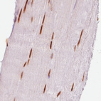 Immunohistochemical staining of human striated muscle shows strong nuclear immunoreactivity in the myocytes.