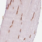 Immunohistochemical staining of human striated muscle shows strong nuclear immunoreactivity in the myocytes.