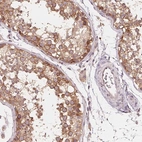 Anti-GIGYF2 Antibody