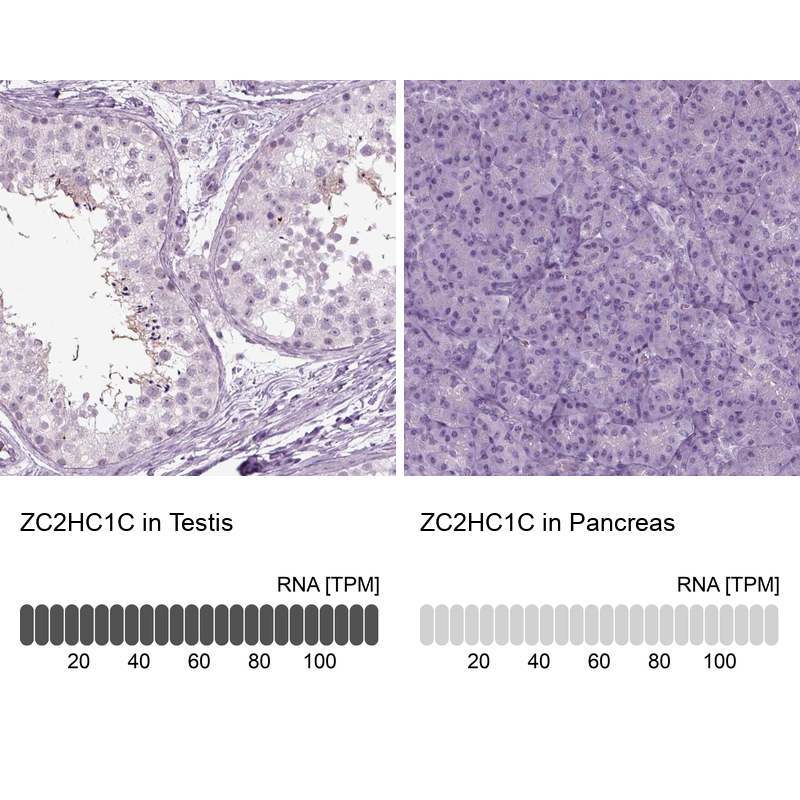 Anti-ZC2HC1C Antibody